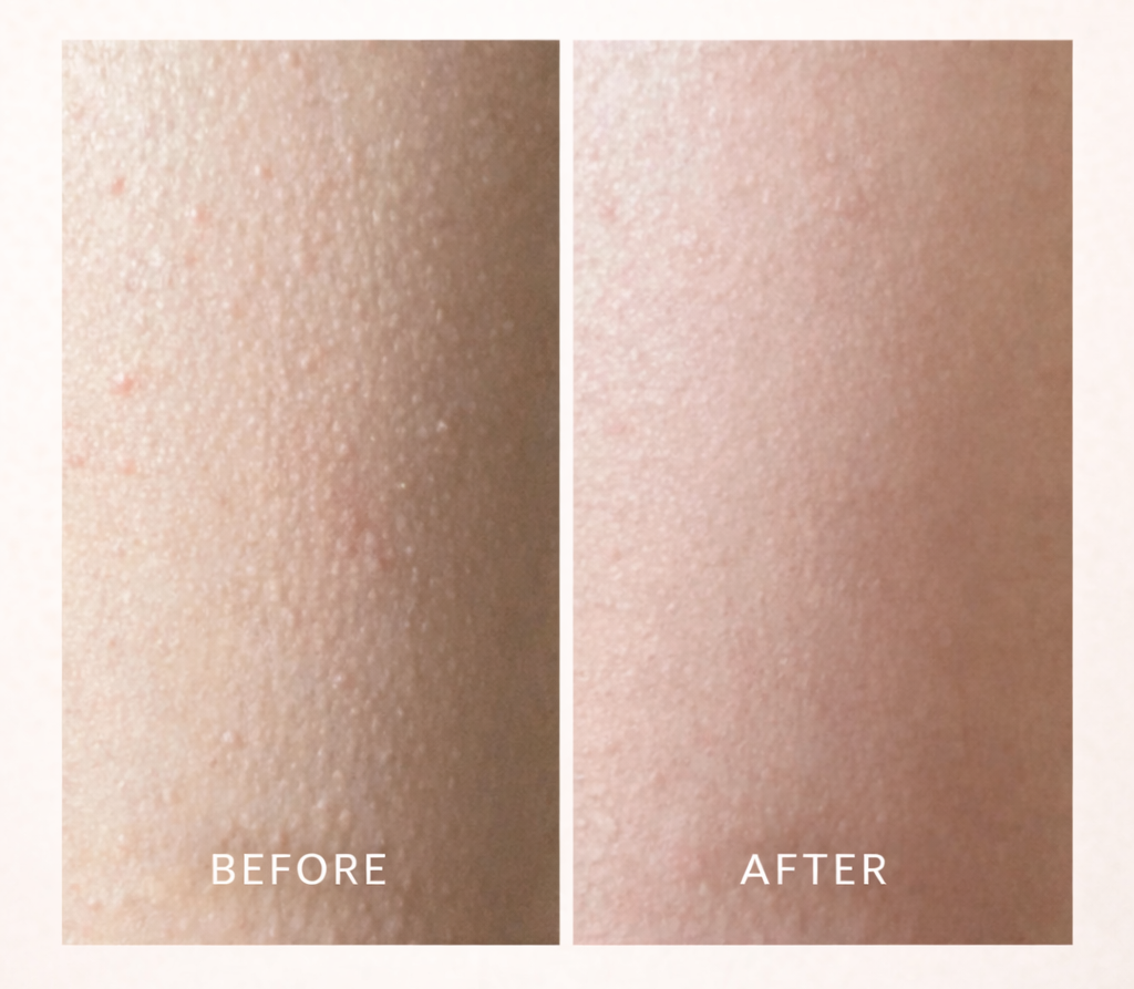 SWEETSNOW 7% Glycolic Acid Exfoliating Solution