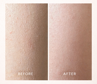 SWEETSNOW 7% Glycolic Acid Exfoliating Solution